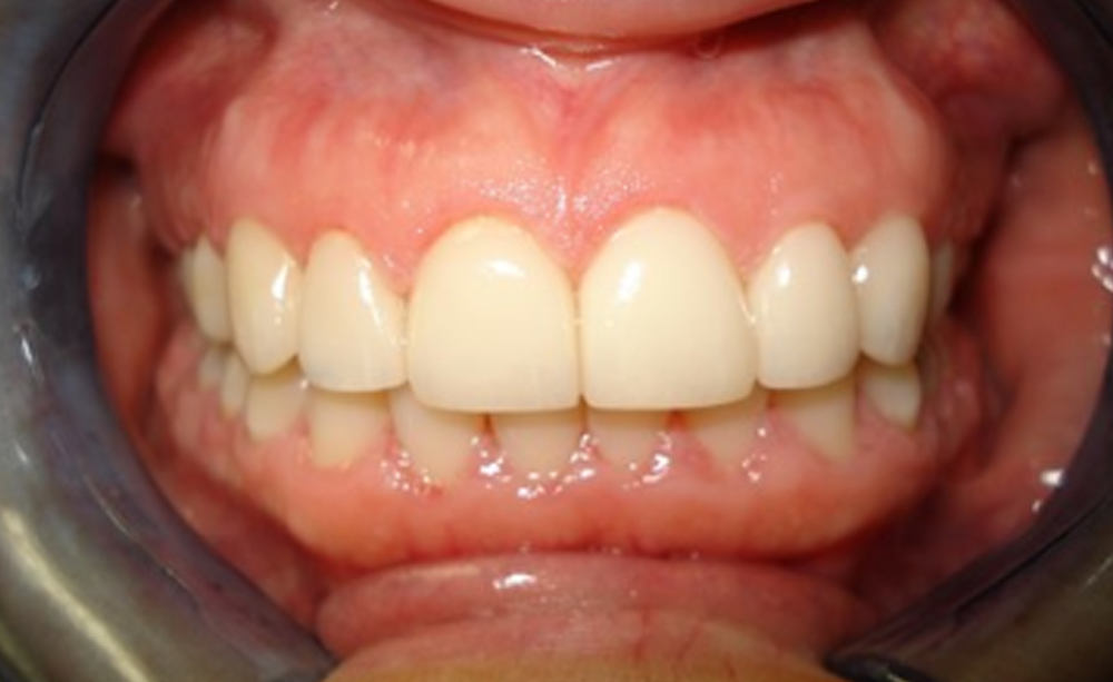  Peak City Family Dentistry Image 